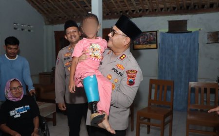 Syahira Peroleh Bantuan Kaki Palsu dari Kapolres Kebumen