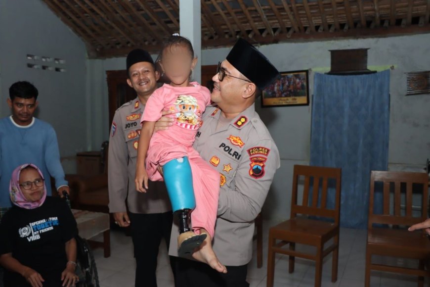 Syahira Peroleh Bantuan Kaki Palsu dari Kapolres Kebumen