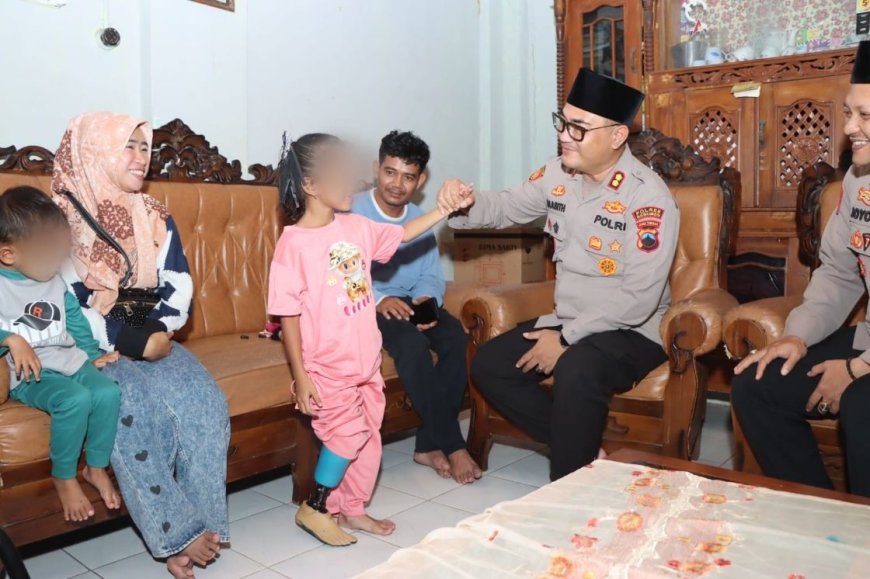 Syahira Peroleh Bantuan Kaki Palsu dari Kapolres Kebumen